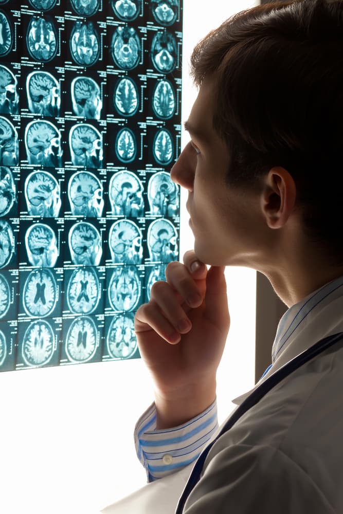 Image of a male doctor examining brain injury X-ray results.