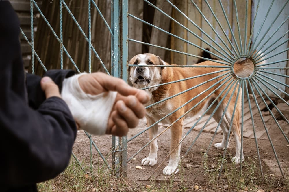 An Alabai male dog bit a man's hand, resulting in injuries. The man's hand is now bandaged—highlighting the importance of animal care and rabies prevention.