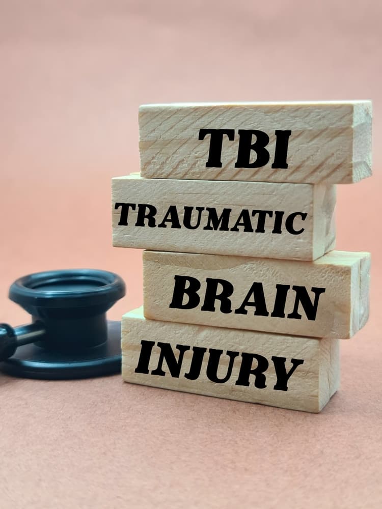 TBI – Traumatic Brain Injury" spelled out on wooden blocks, representing a medical awareness concept.